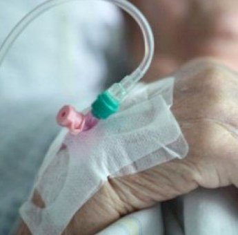 Waspada! Stroke Bisa Sebabkan Kematian, Kenali Gejala dan Risikonya