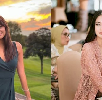 Aurelie Moeremans Kecelakaan di AS, Alami Gegar Otak dan Panick Attack