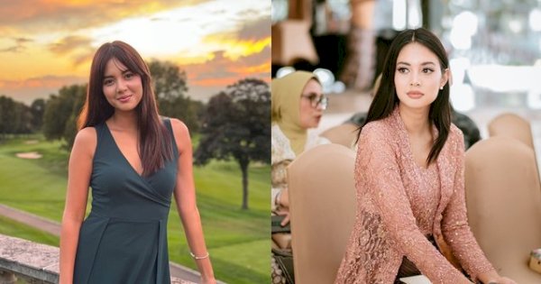 Aurelie Moeremans Kecelakaan di AS, Alami Gegar Otak dan Panick Attack